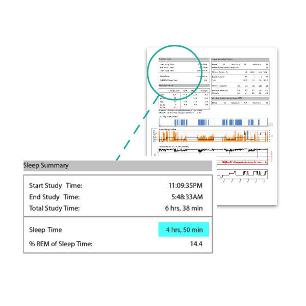CPAP Concierge Home Sleep Apnea Test