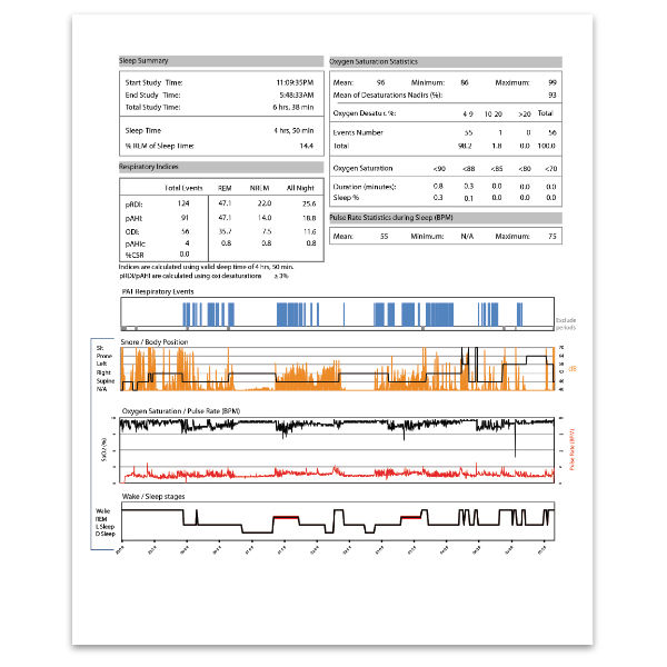 CPAP Concierge Home Sleep Apnea Test